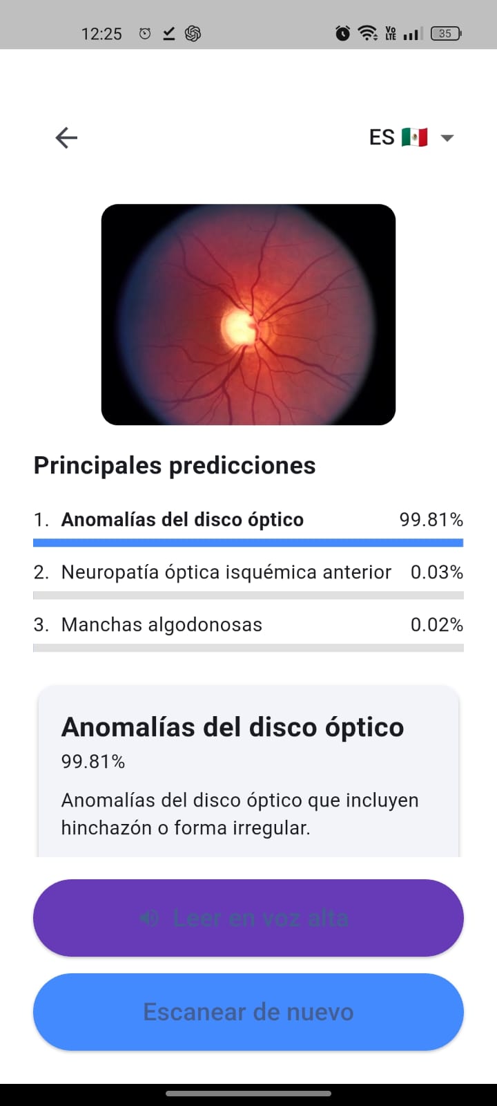 OpticalApp screenshot showing an anomalous fundus analysis.