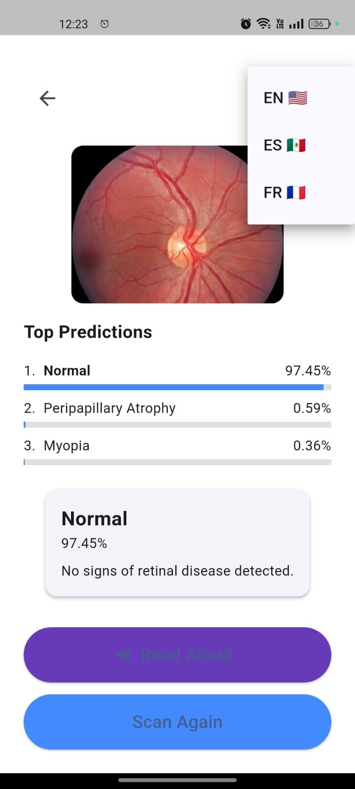 OpticalApp screenshot showing a healthy fundus analysis.